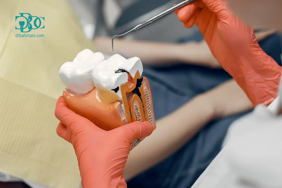 12 اشتباه ذهنی درباره عصب کشی دندان؛ آیا درمان ریشه واقعاً درد دارد؟