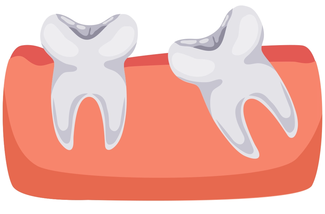 بررسی خدمات کلینیک دندان پزشکی تحت بیهوشی و 5 مزیت آن