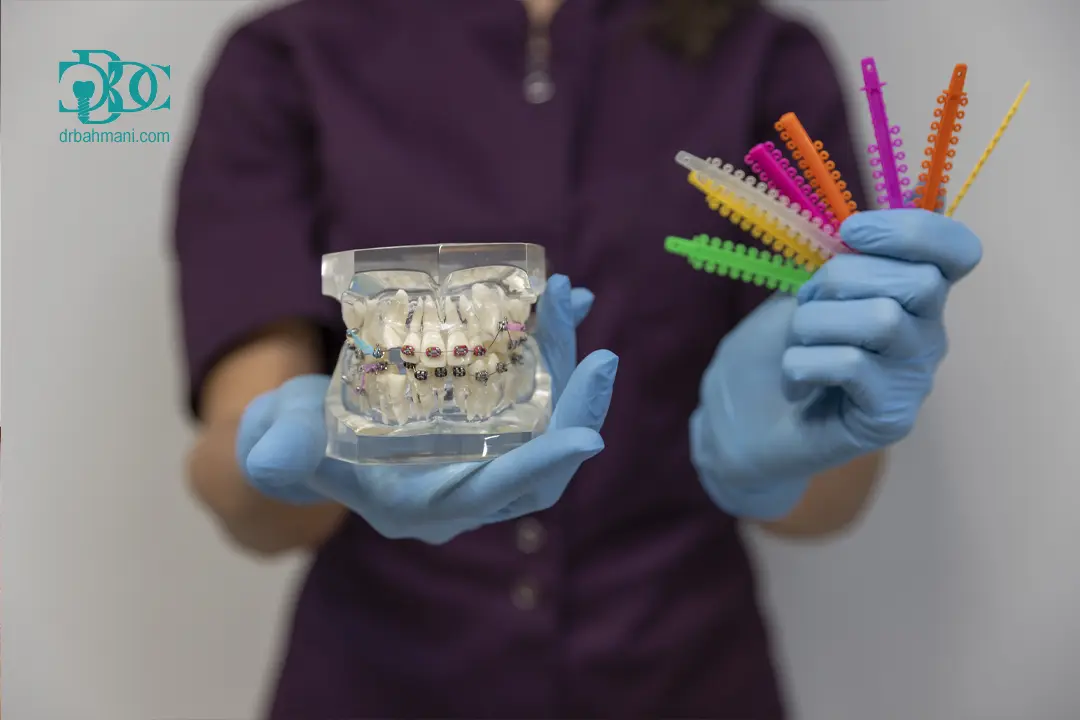 مقایسه ارتودنسی ثابت و متحرک از نظر هزینه، طول درمان و نتیجه نهایی