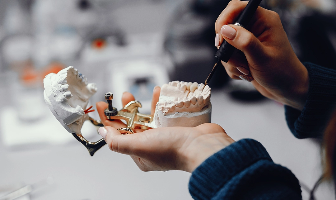 پیوند استخوان فک برای ایمپلنت دندان؛ واقعاً چه زمانی لازم می‌شود؟