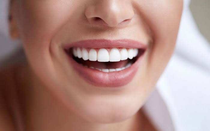 لمینت سرامیکی برای چه کسانی مناسب است؟