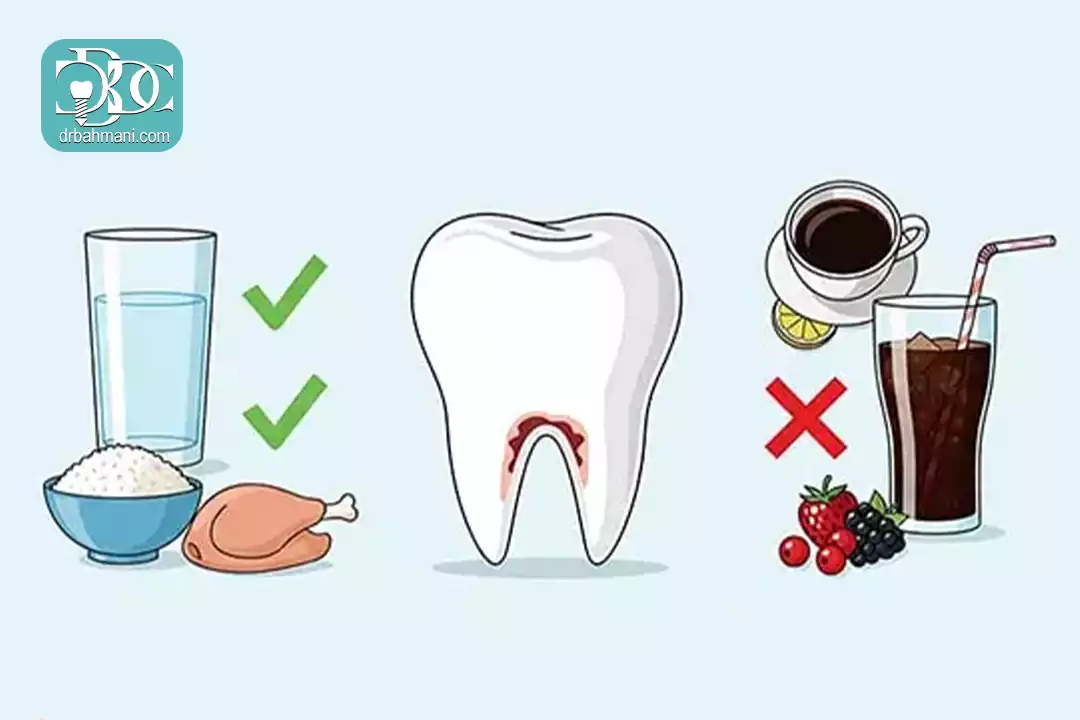 بعد از بلیچینگ دندان چه بخوریم و چه نخوریم؟